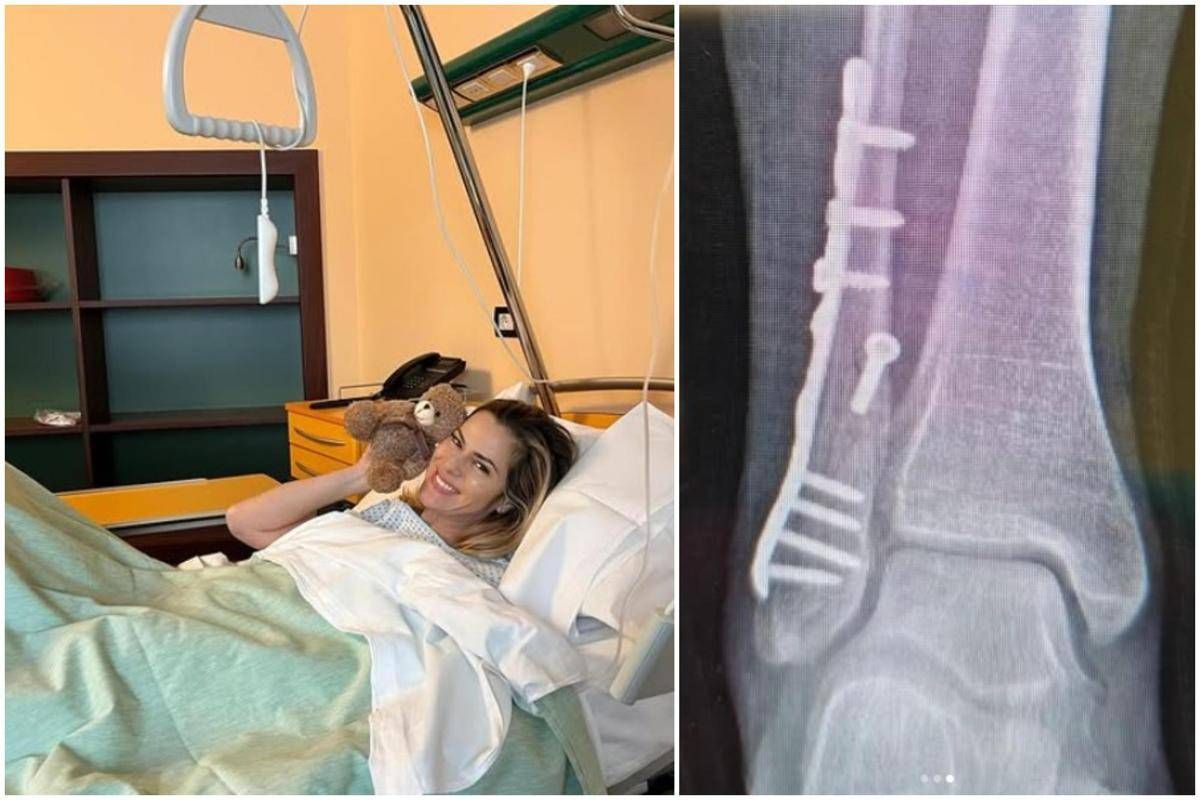 Thais Wiggers, operazione alla caviglia dopo incidente: "Comincio anno con un piede bionico" - 