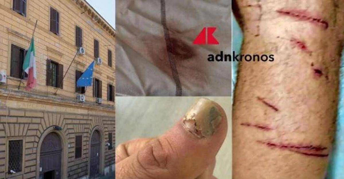 Denunciò botte e sequestro in cella: "Ora vivo nella paura, colpisce il silenzio delle istituzioni" - 