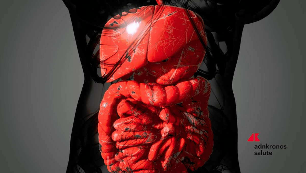 Malattia di Crohn, solo 1 paziente su 3 riceve supporto nutrizionale - 