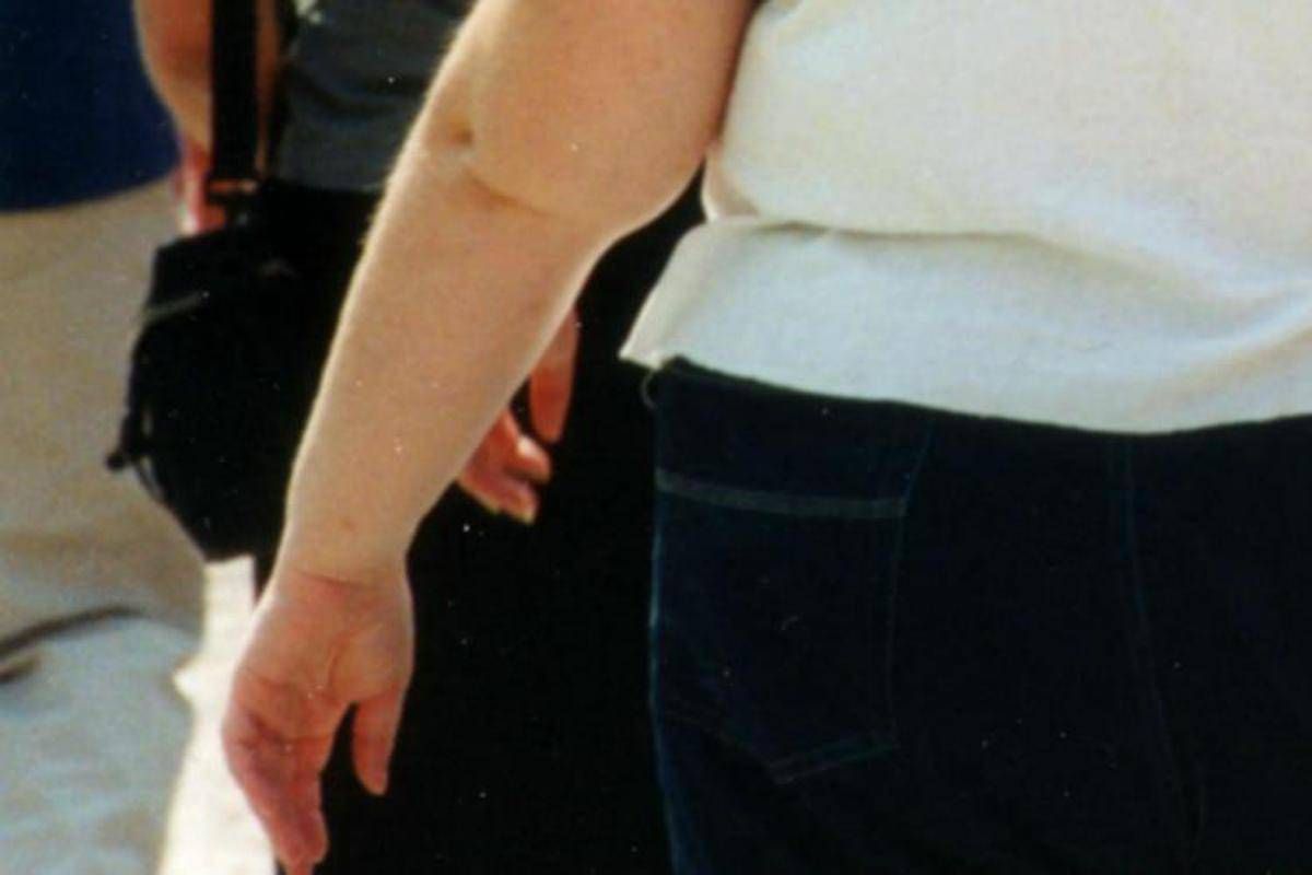 Una morte per malattie infettive su 10 è legata all'obesità, lo studio - 