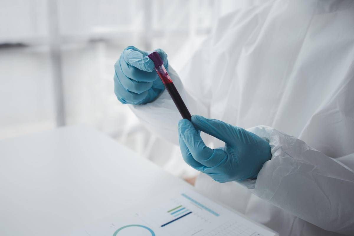 Epatite A in forte crescita in Italia: Lazio, Campania e Puglia le regioni con più casi - 