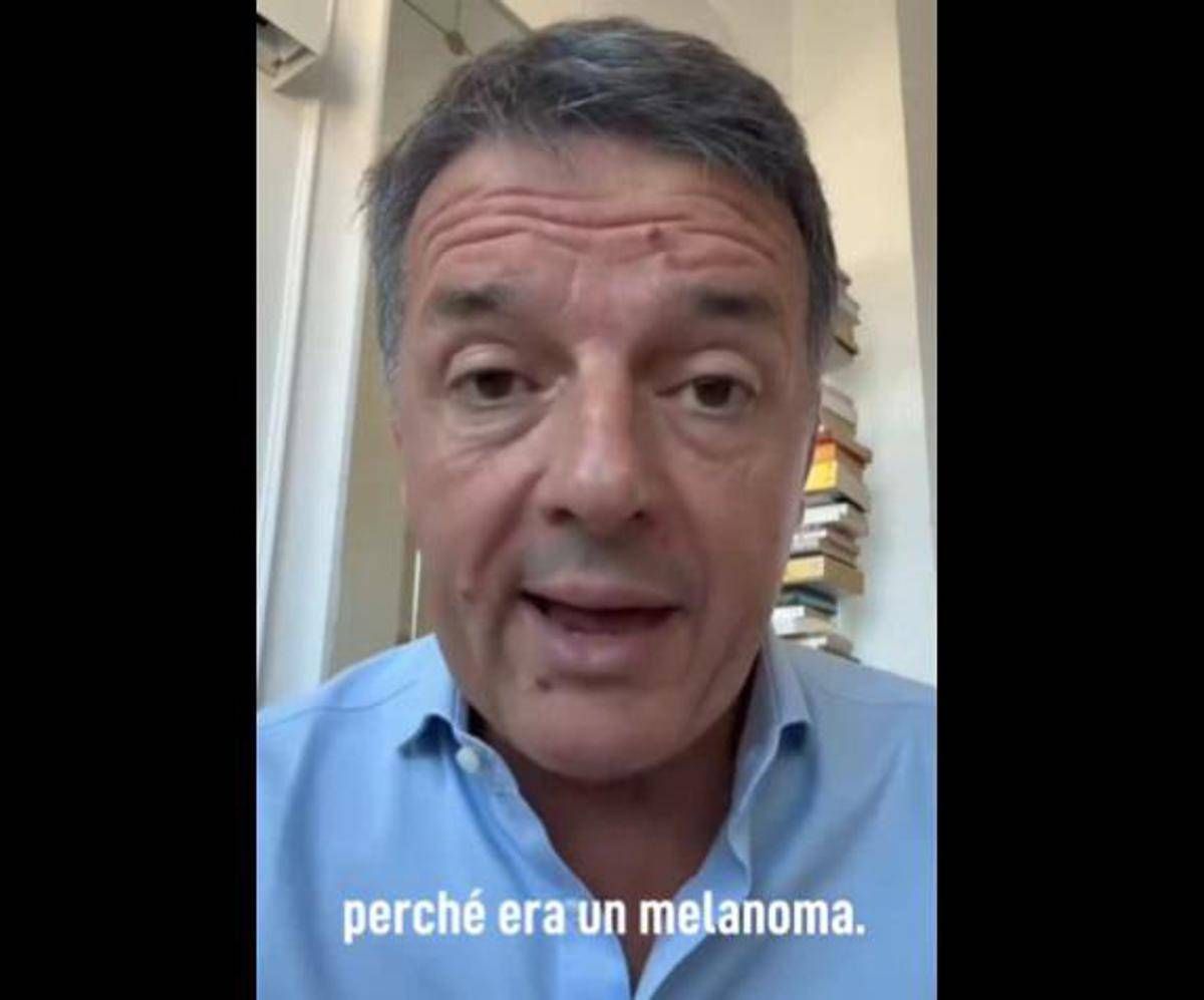 Renzi e il melanoma: "L'ho rimosso, nessun rischio per me ma bisogna controllarsi" - 