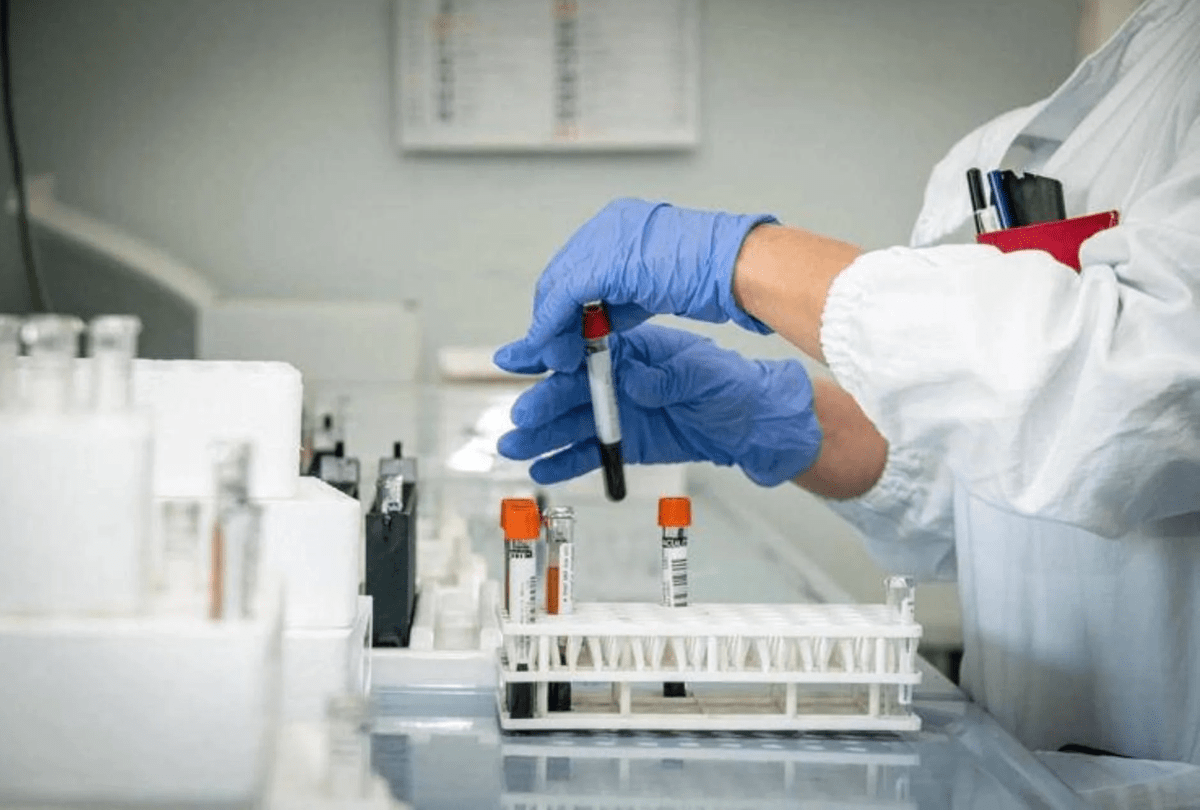 Alzheimer, allo studio nuovo test del sangue per diagnosi precoce - 