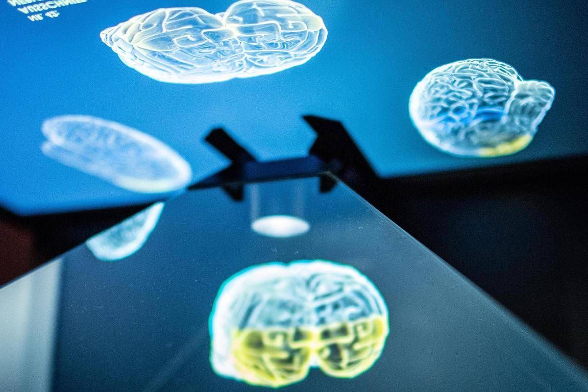 Ictus, ecco come l'emisfero sano del cervello influenza la ripresa: la ricerca rivoluzionaria - 