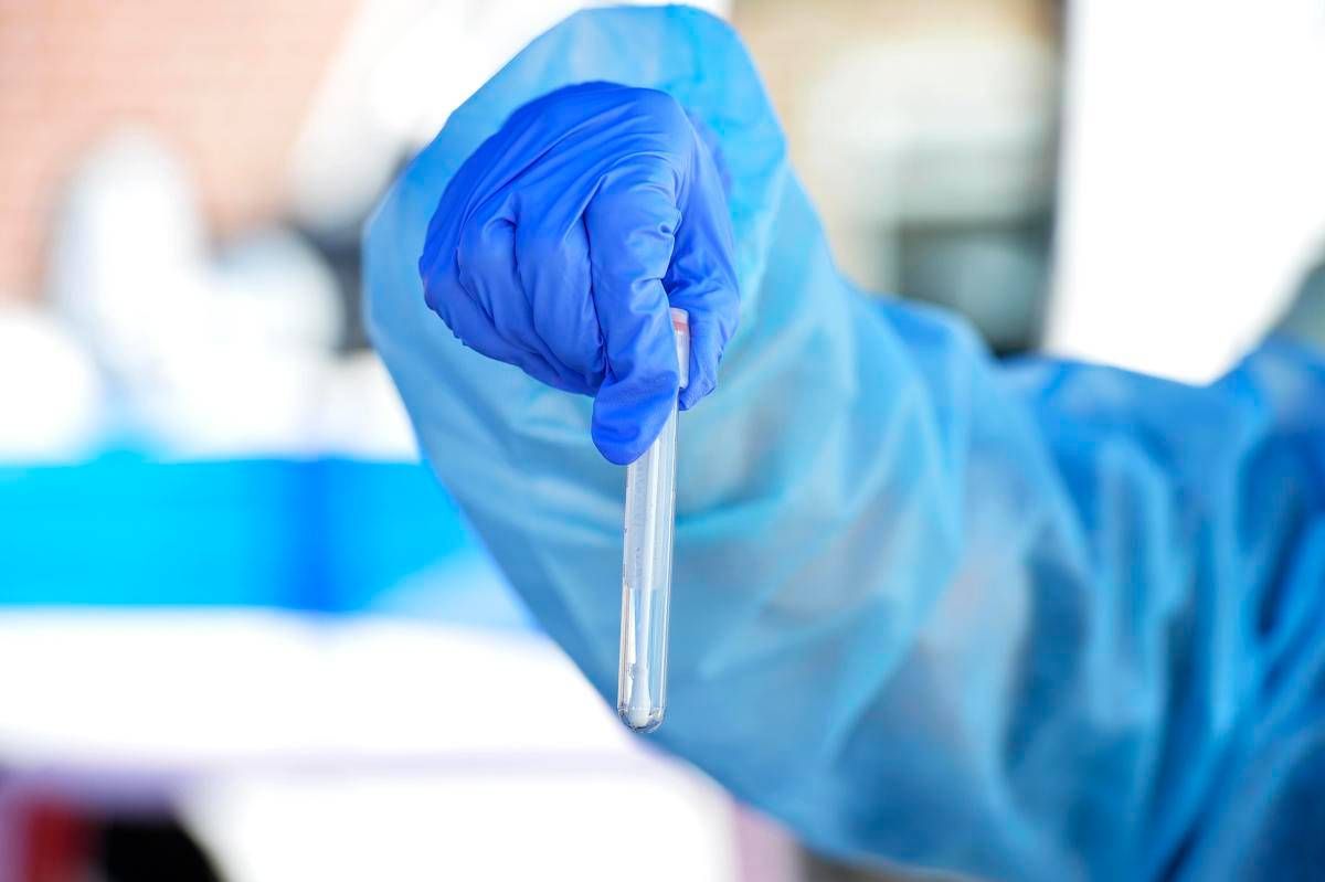 Hantavirus, il punto: contagio e sintomi, cosa c'è da sapere e come proteggersi - 