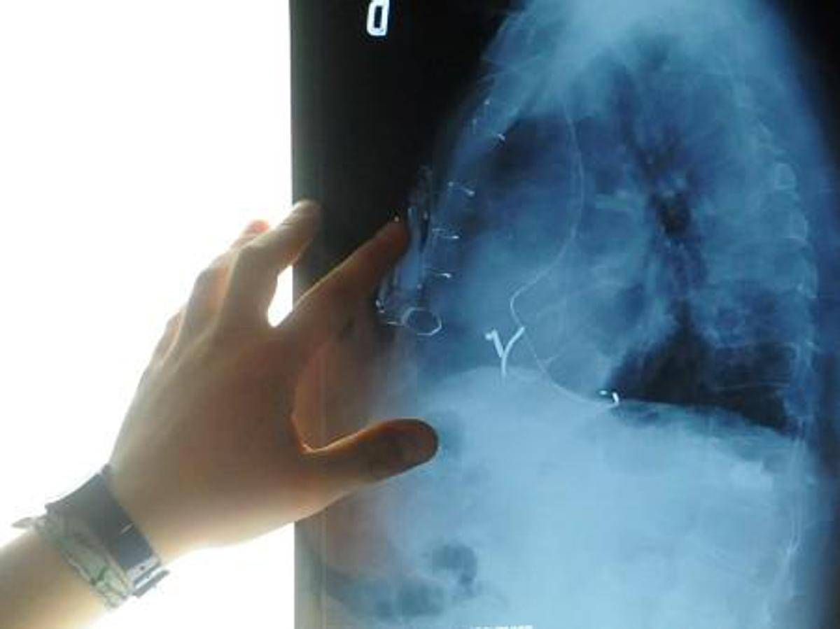 Radiologia interventistica, Ssn e fondazioni per cure più accessibili - 