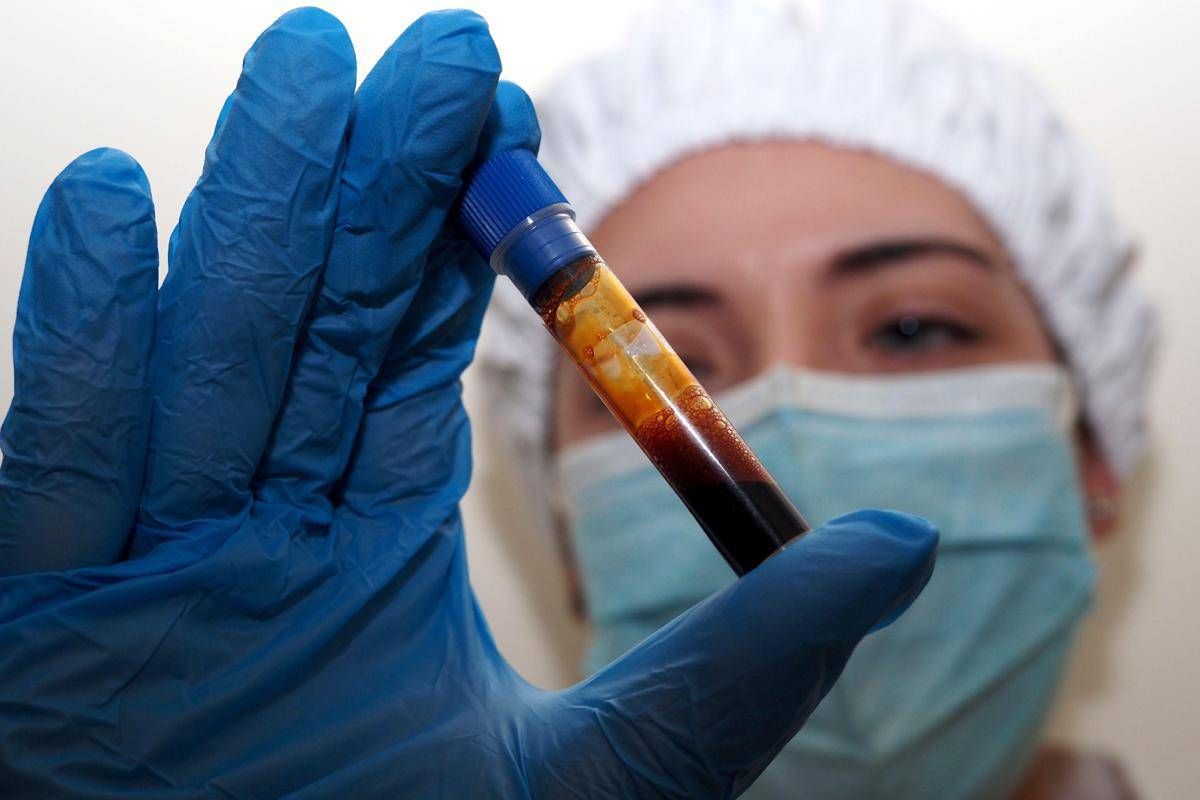 Hantavirus, negativo il turista inglese in quarantena a Milano. Test per una donna ricoverata a Messina - 