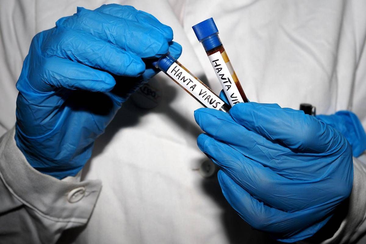 Hantavirus, l'Oms avverte: è più contagioso non appena compaiono i sintomi - 