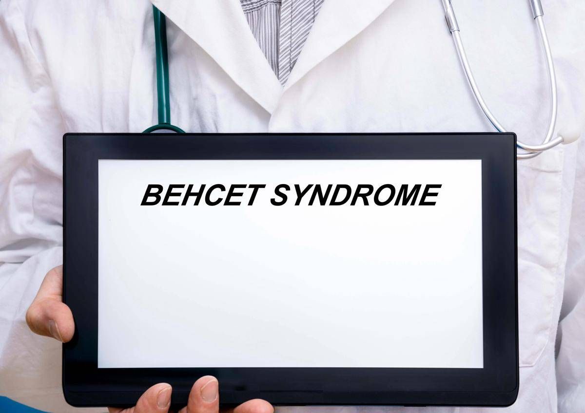 Giornata sindrome Behçet, esperto: "Oggi possiamo prevenire cecità" - 