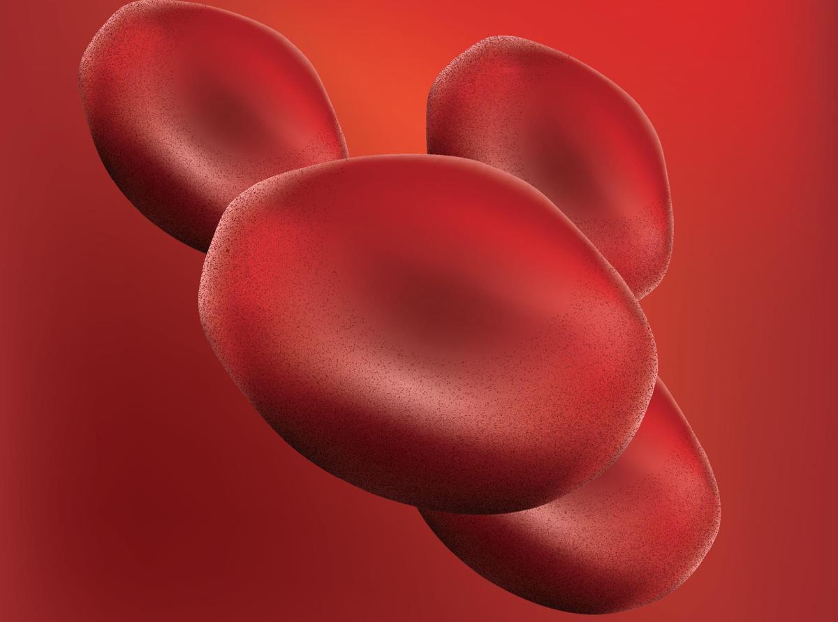 Autoemotrasfusione di ozono anti-aging, cos'è: ma fa bene davvero? - 