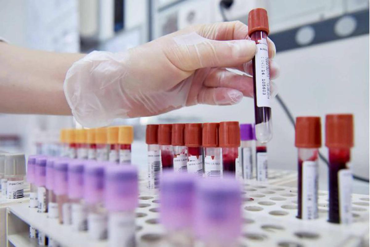Hiv, dalla Sicilia il modello per estendere terapie long acting - 