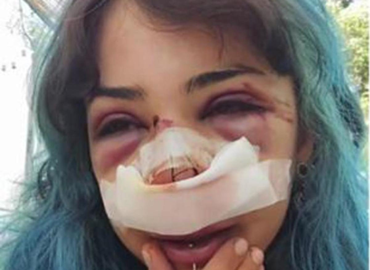 Bari, studentessa picchiata nei bagni denuncia nuovo episodio: "Mi hanno accerchiata" - 