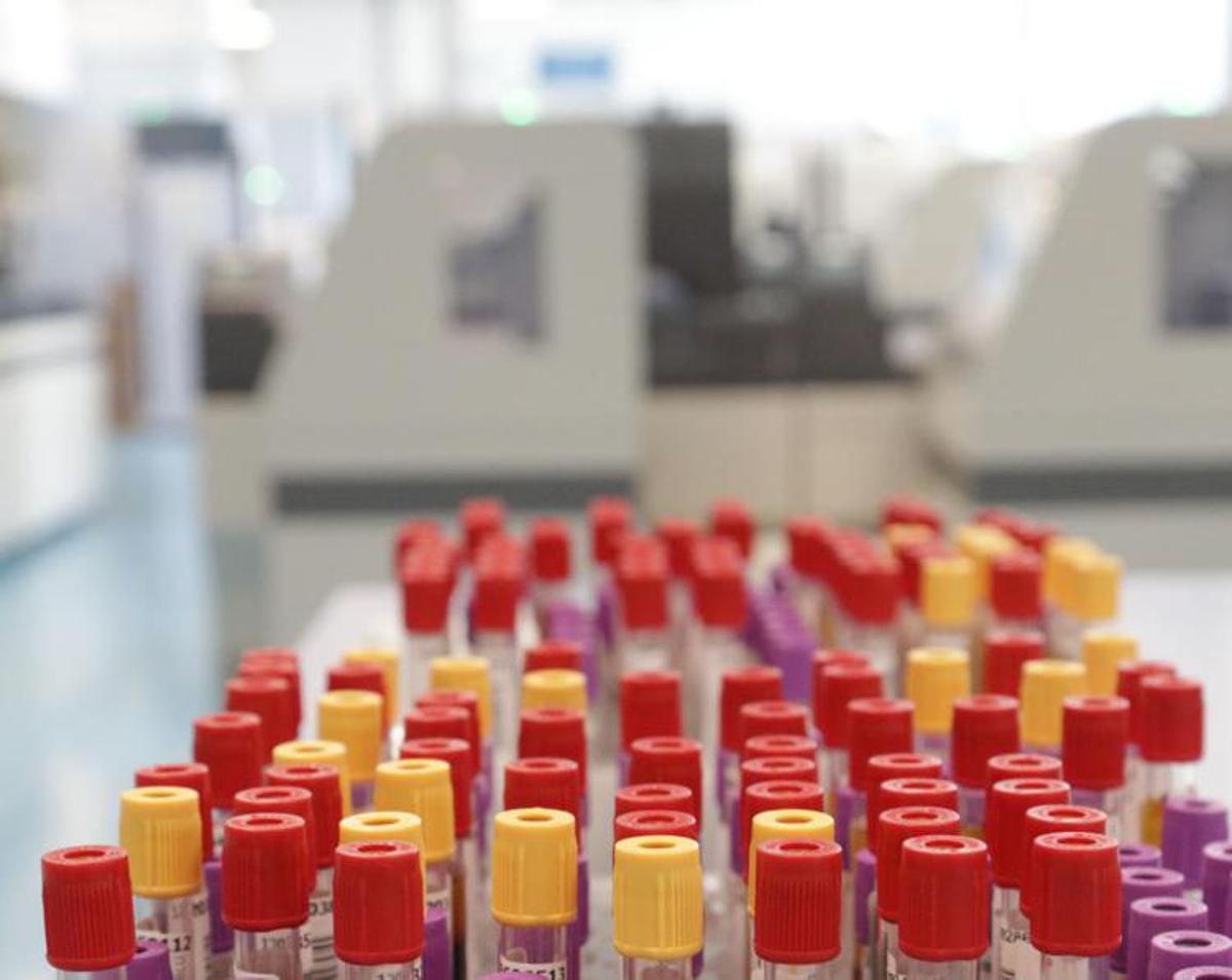 Malaria in aeroporto in Germania, gli esperti: "Campanello d'allarme, ma il rischio resta contenuto" - 
