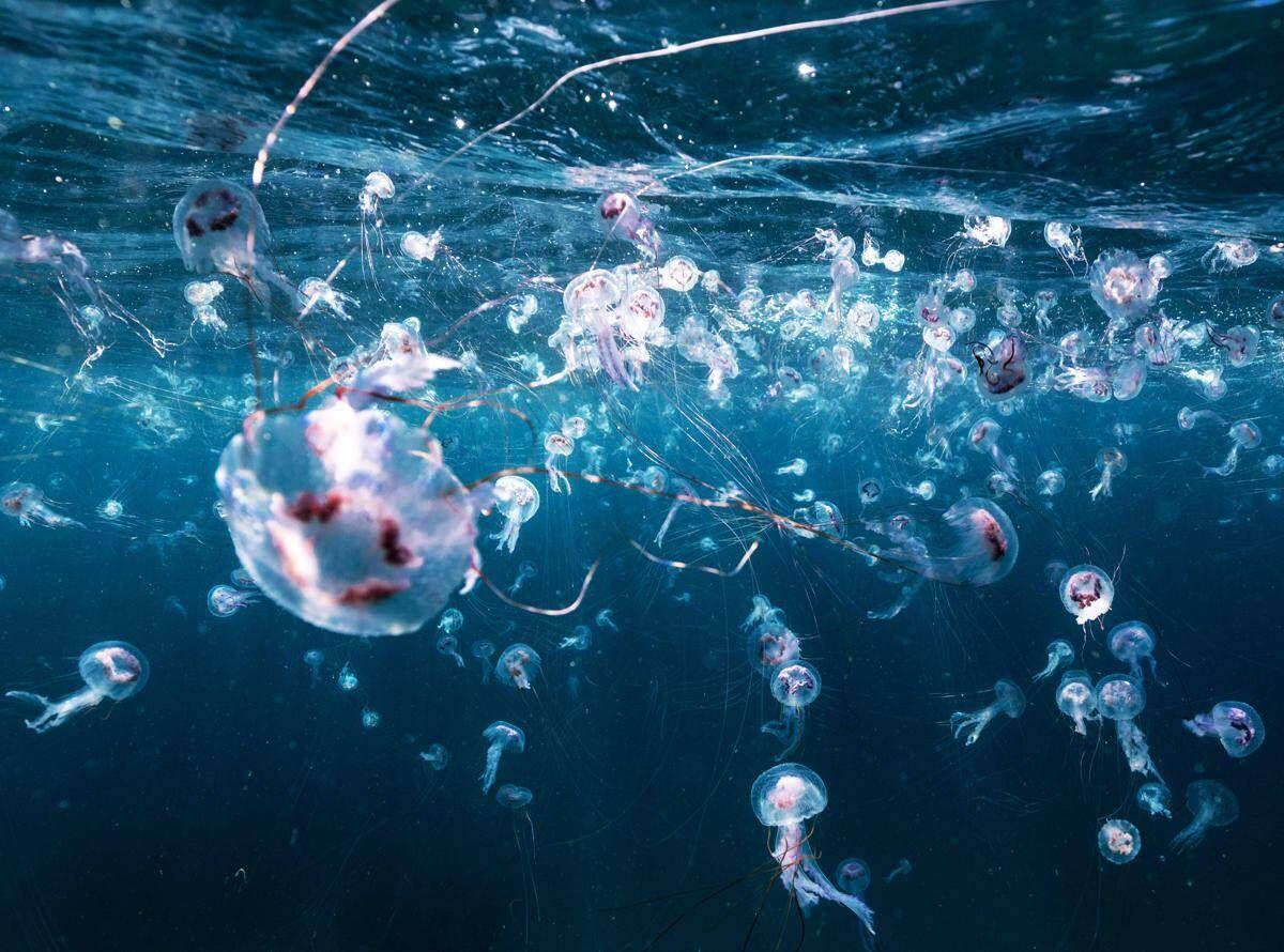Bimbi in vacanza tra caldo record e punture di zecche e meduse, i consigli dell'esperta: "Ecco quando andare in ospedale" - 