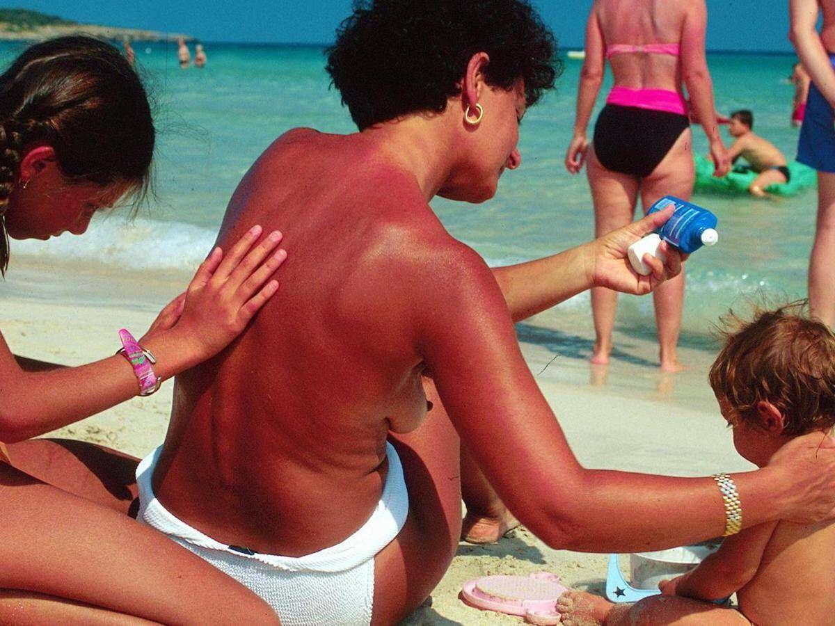 Creme solari fatte in casa, il monito degli esperti: "Pericoloso trend guidato dalle fake news" - 