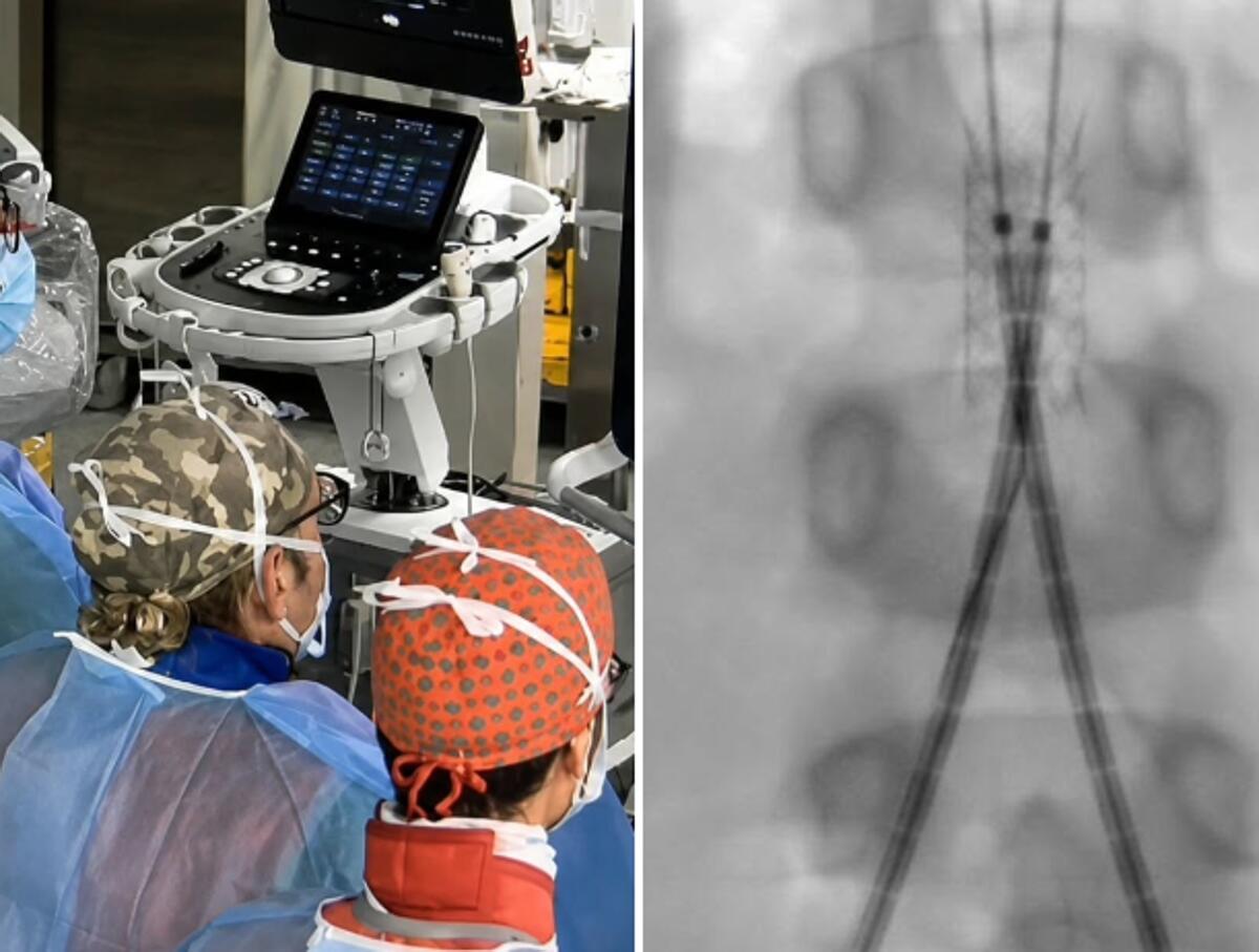 Incidente con un'acquasantiera in chiesa, bimba di 6 anni operata d'urgenza all'aorta a Bari - 