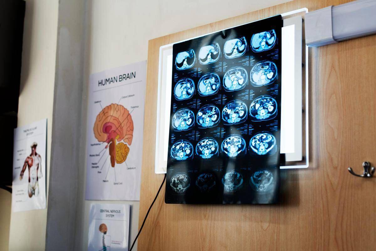 "11 anni di chemio per un tumore che non c'era", la diagnosi sbagliata e l'incubo - 