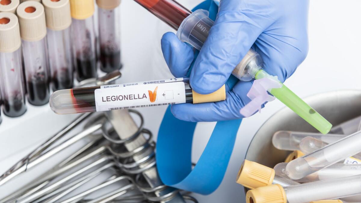 Legionella ad Alcamo: 55enne in rianimazione, Asp Trapani avvia verifiche nella sua abitazione - 
