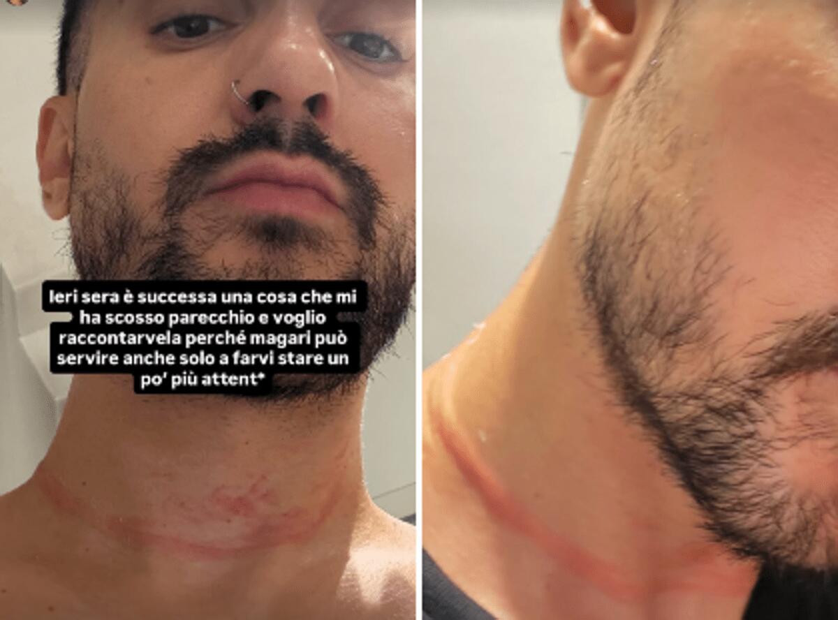 Mr. Daniel, il make-up artist dei vip, aggredito e rapinato a Milano: il racconto choc sui social - 
