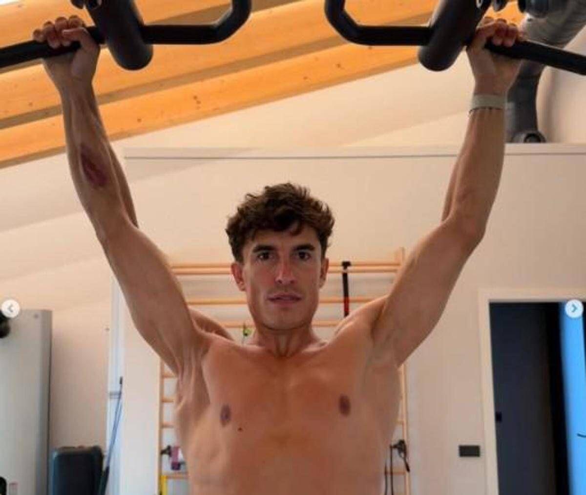 Marquez e la foto choc: il pilota mostra la spalla 'deformata' - 