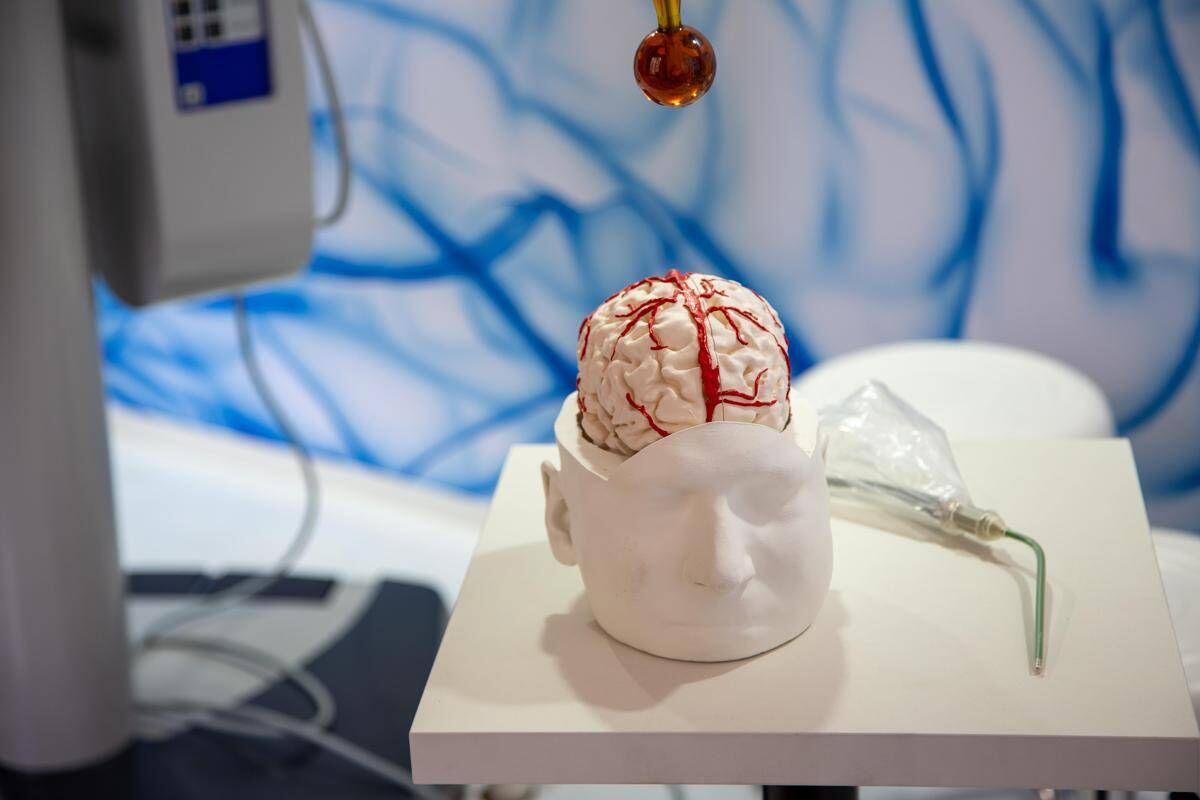 Dai gliomi al Parkinson, così l’intelligenza artificiale aiuta la Neurochirurgia - 