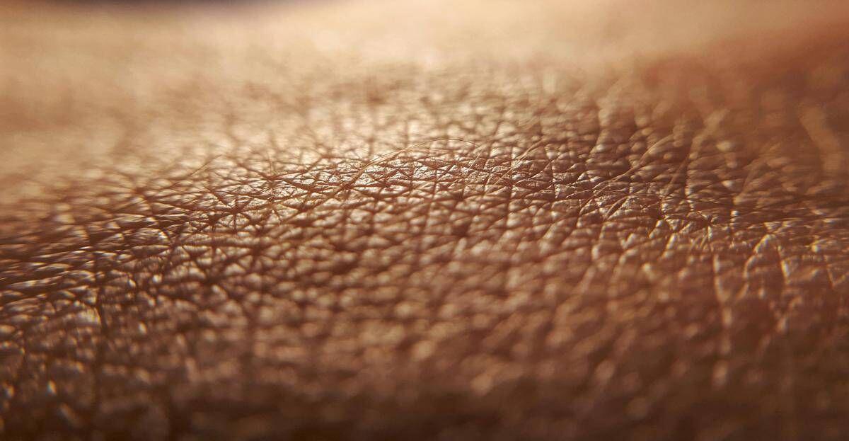 Dermatite atopica, quando la pelle condiziona la vita, 'Diari atipici' dà voce ai pazienti - 