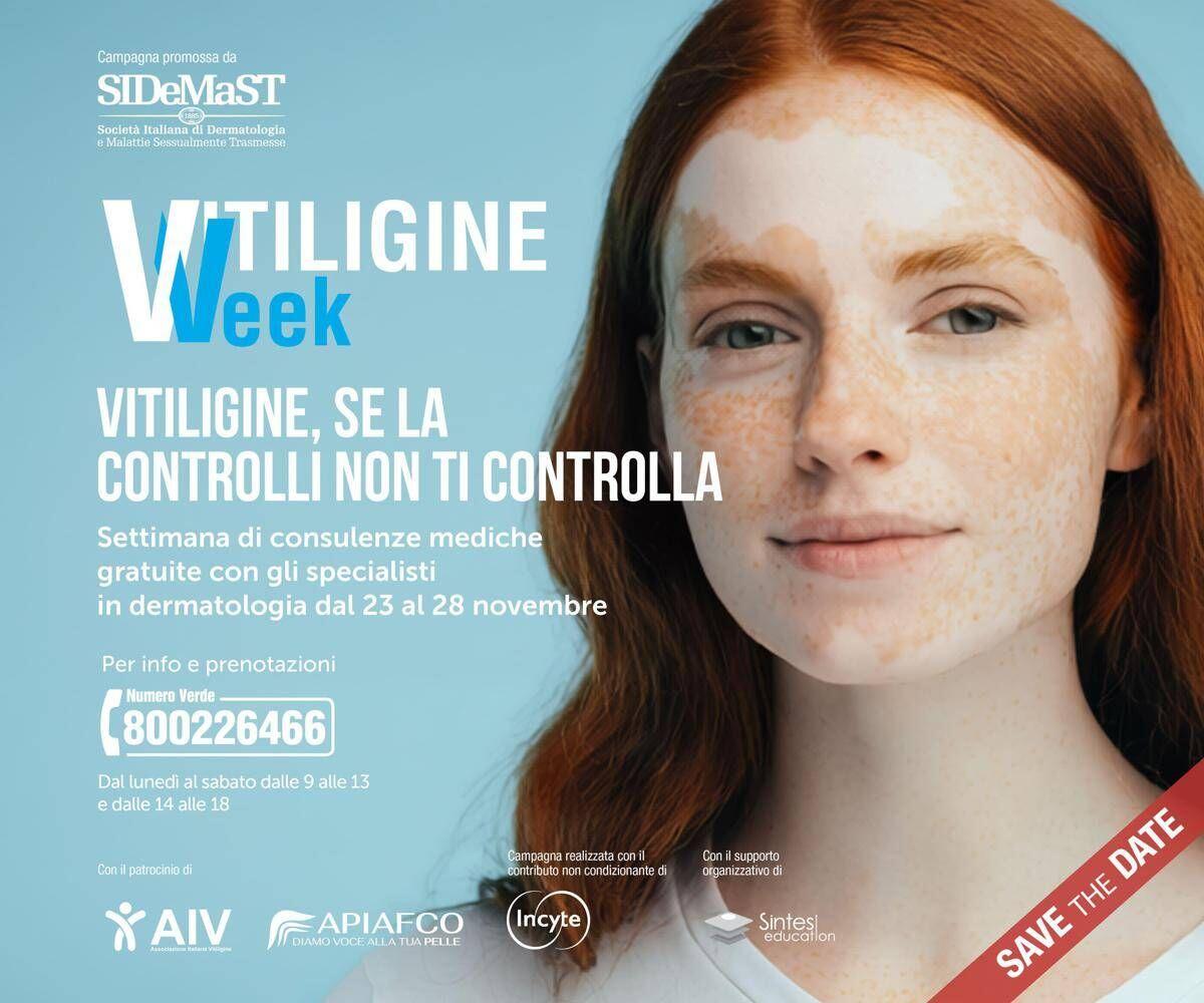 Vitiligine week, Sidemast: "Circa mille consulenze dermatologiche gratuite" - 