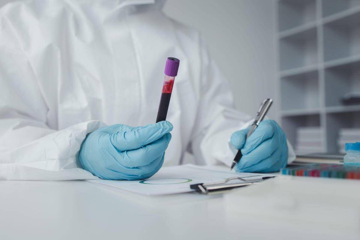 In Francia primo caso umano di virus Shamonda, il paziente è morto: alert Ecdc - 