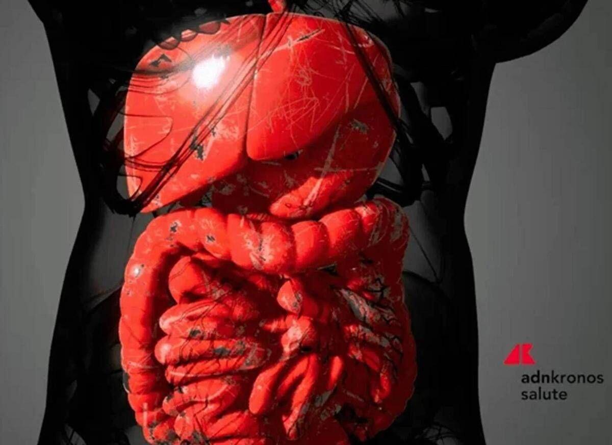 Malattie infiammatorie intestinali, rimborsabile guselkumab per colite ulcerosa e Crohn - 