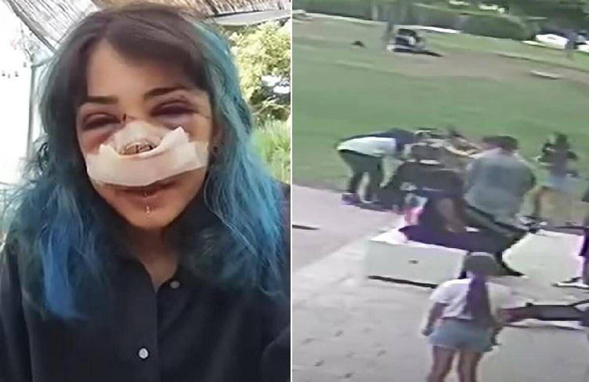 Picchiata al Parco Rossani, processo al via il 4 novembre: la 26enne ha pubblicato il video dell’aggressione - 