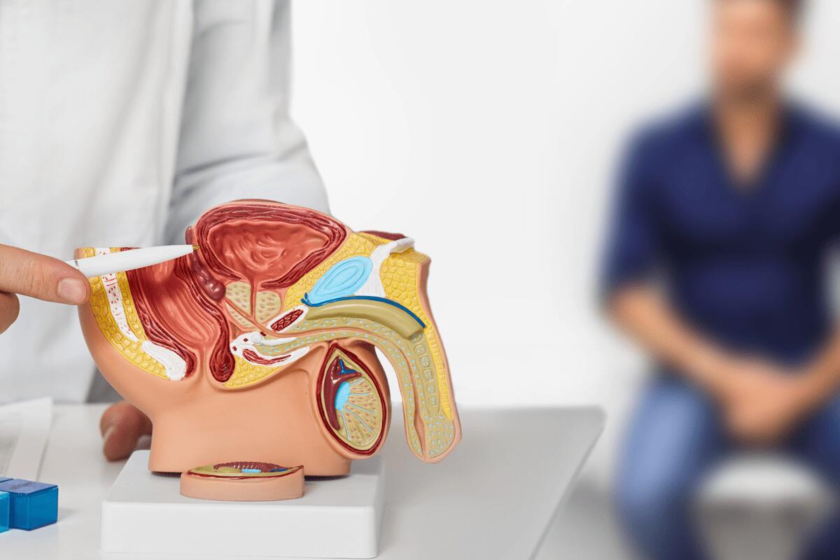 Cancro alla prostata, apalutamide con terapia ormonale riduce del 62% rischio di recidiva o morte - 