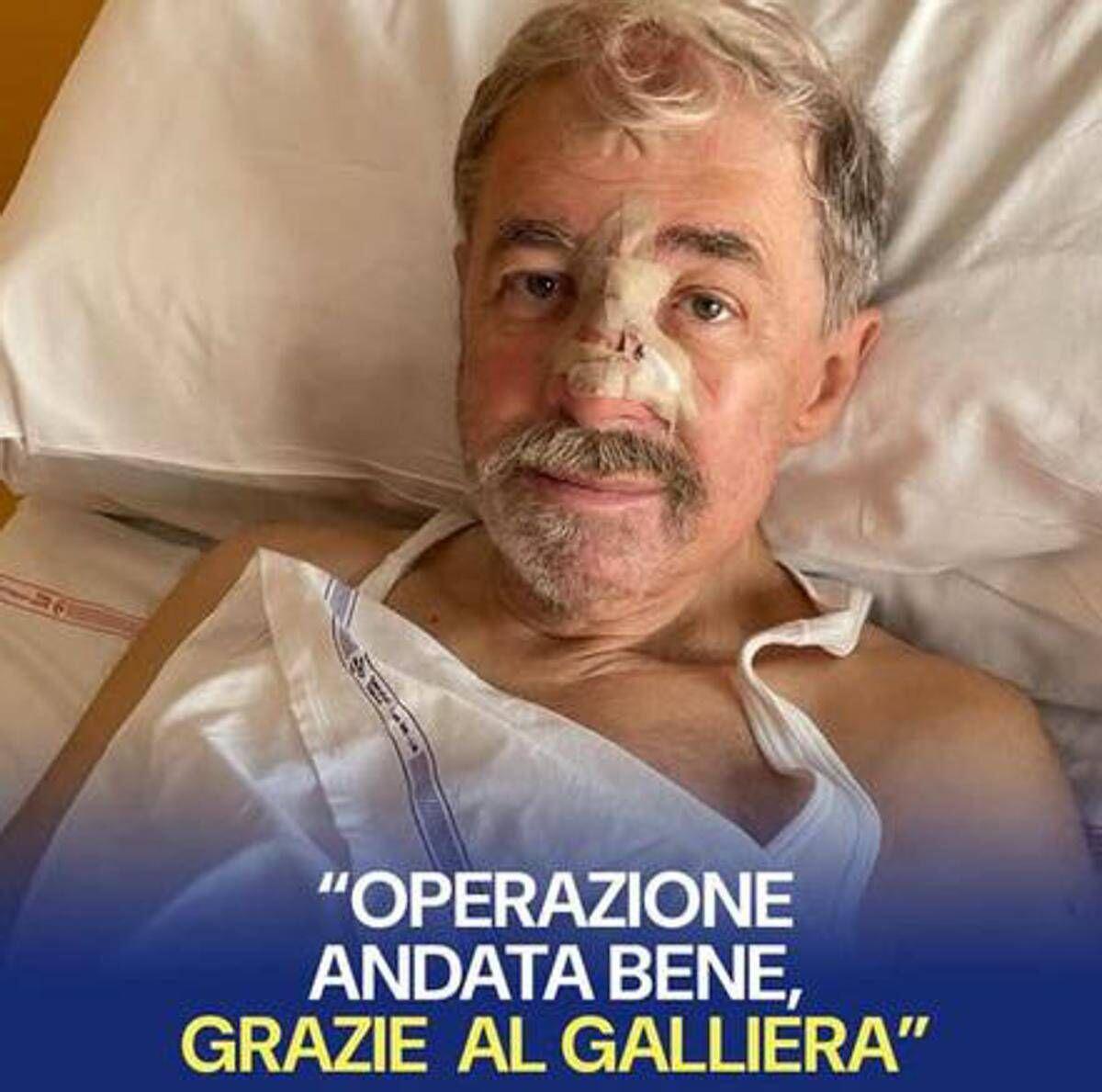 Marco Bucci operato al Galliera per la ricostruzione cutanea al naso: "Sto bene" - 